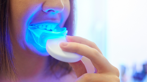 best teeth whitening kit