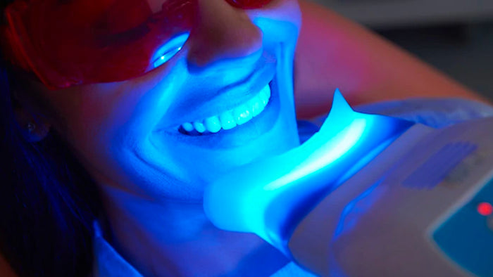What to look for in a teeth whitening kit?